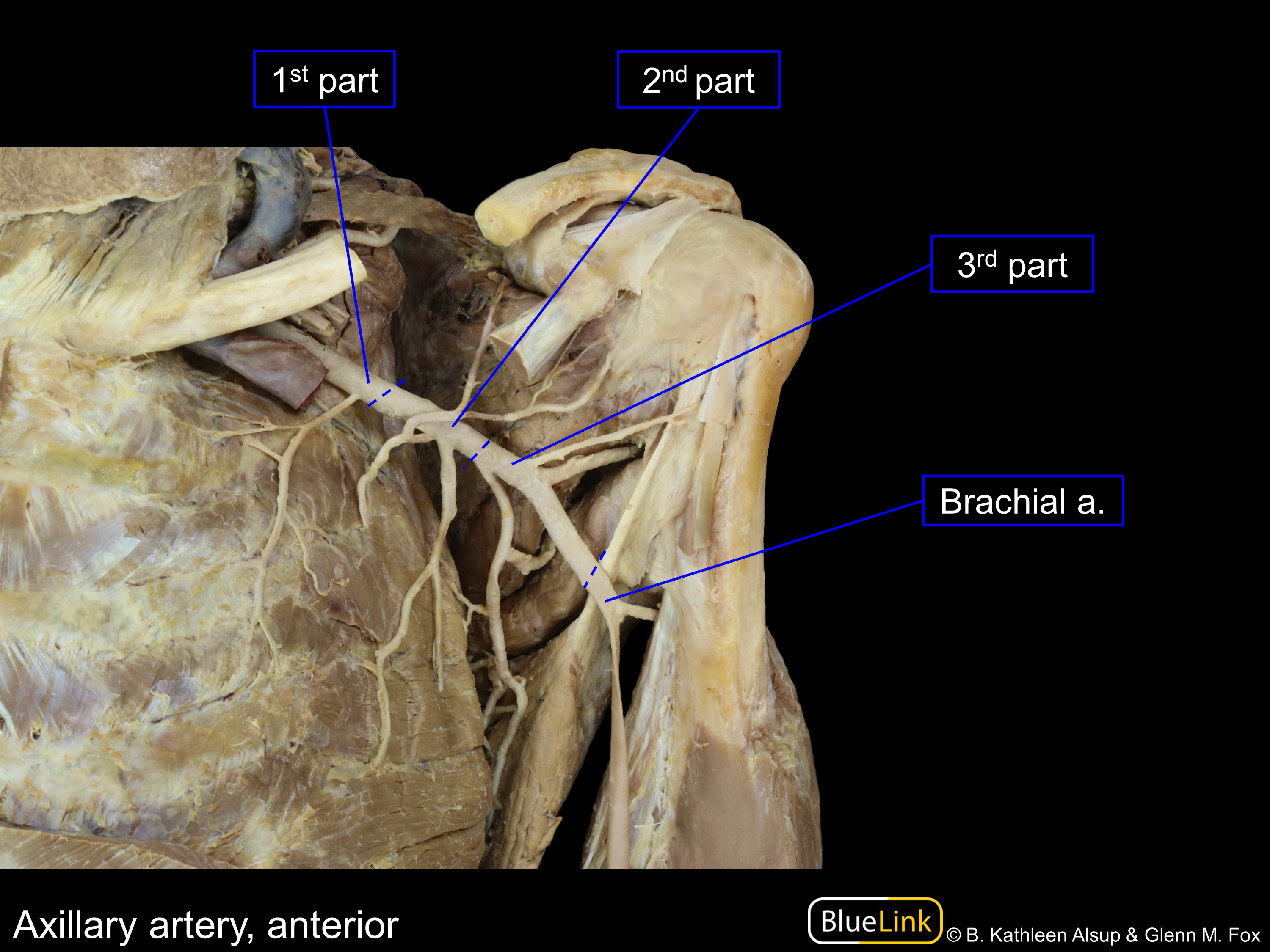 brachial plexus cadaver labeled