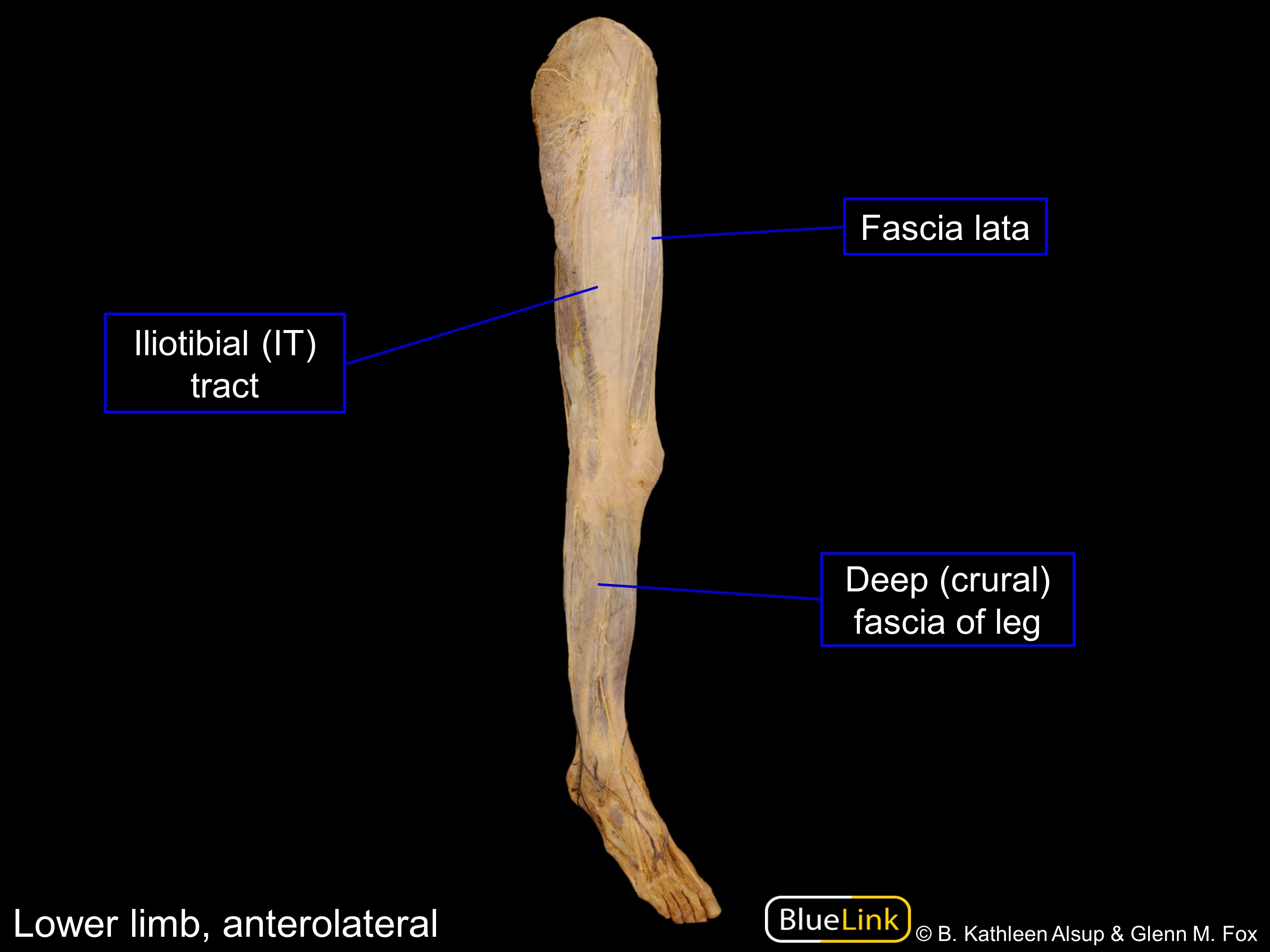 Photograph of left lower leg medial aspect (left) and anterior