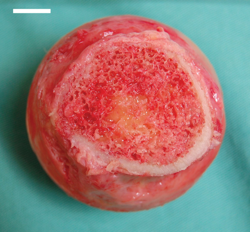 This photograph shows the bone marrow.
