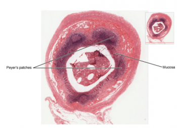 Module 8: Lymphatic System – Anatomy 337 eReader