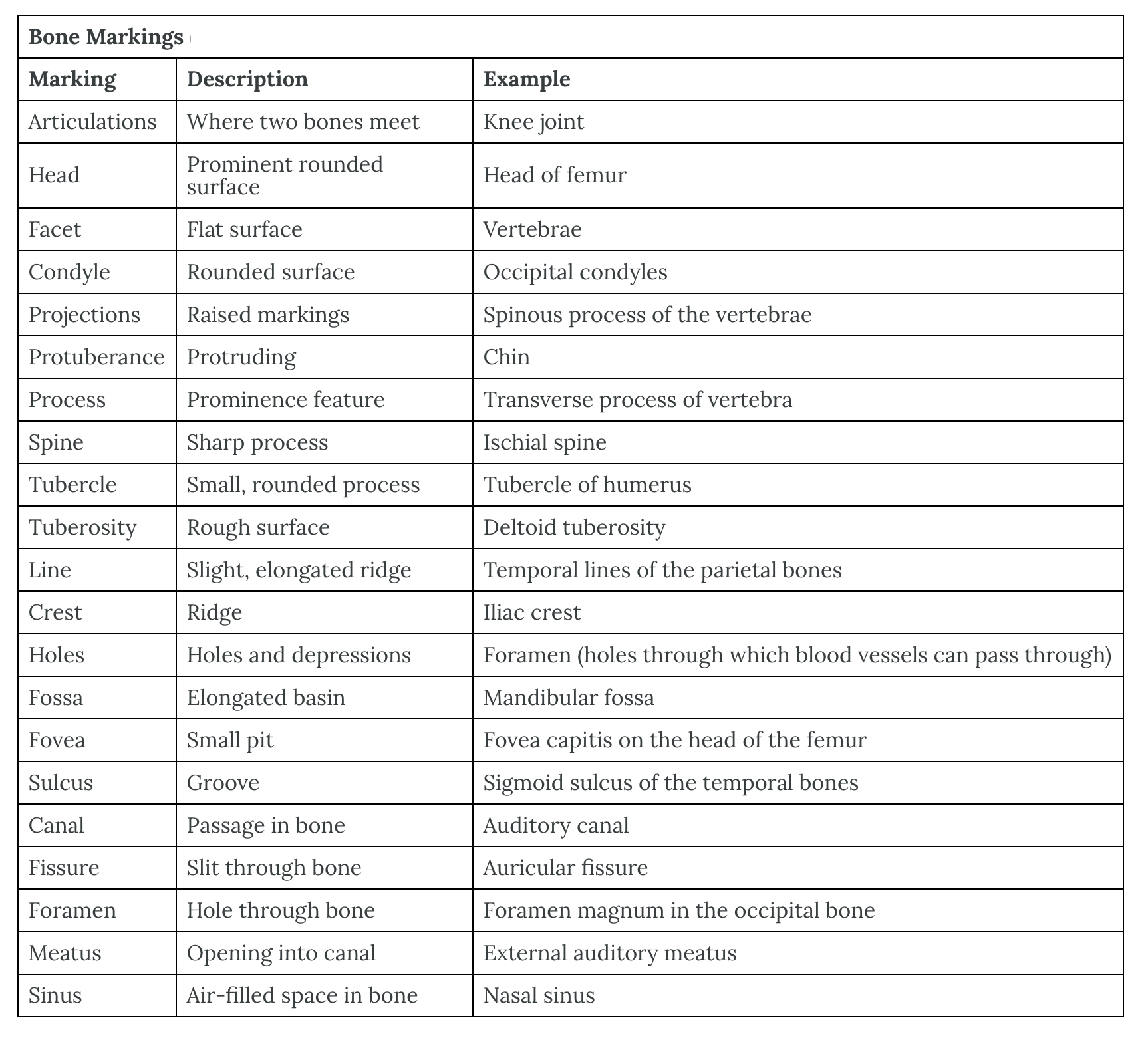 The image is of a table describing different bone markings and providing examples of the markings.