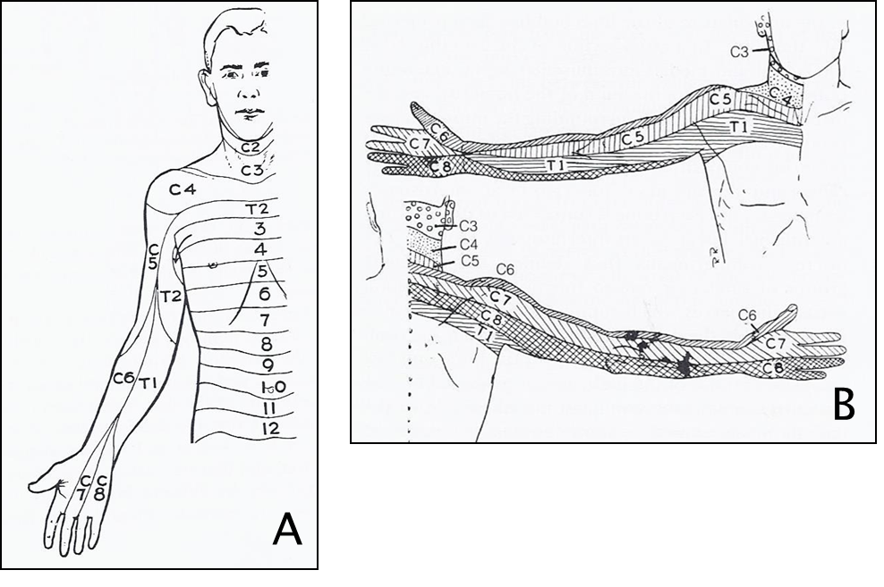 Figure 3-10 A) Dermatome pattern of trunk and upper limb. From W. Henry Hollinshead, Anatomy for Surgeons: Volume 3 The Back and Limbs, 3rd Edition;1982, Harper & Row; ISBN 0-06-141266-X (v. 3); figure 3-36 B) Dermatome pattern for upper limbs. From Woodburne & Burkel, Essentials of Human Anatomy, Eighth Edition, 1988, Oxford University Press, 0-19-504502-5; Figure II-32.
