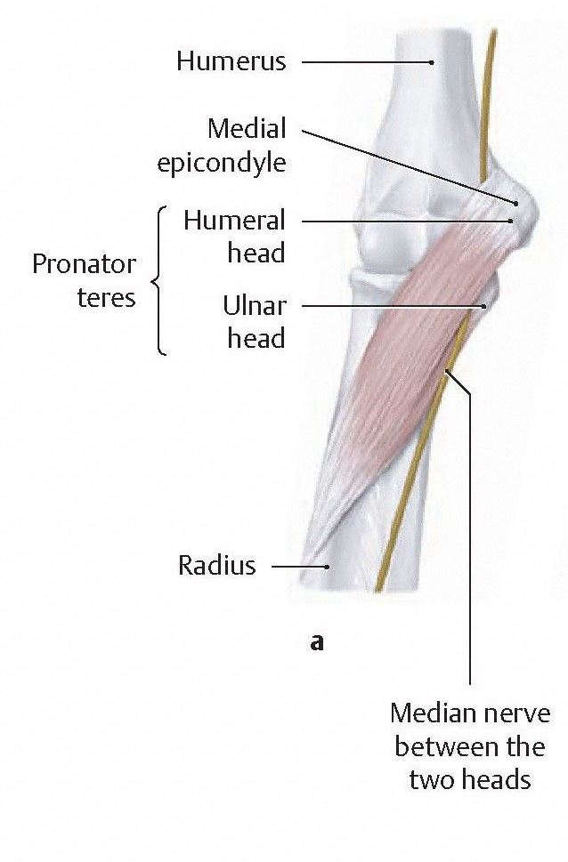 Pronator teres crossing the proximal radioulnar joint. Note that the median nerve passes between its two head. From Schuenke et al., THIEME Atlas of Anatomy, THIEME 2007, pp. 344-345.