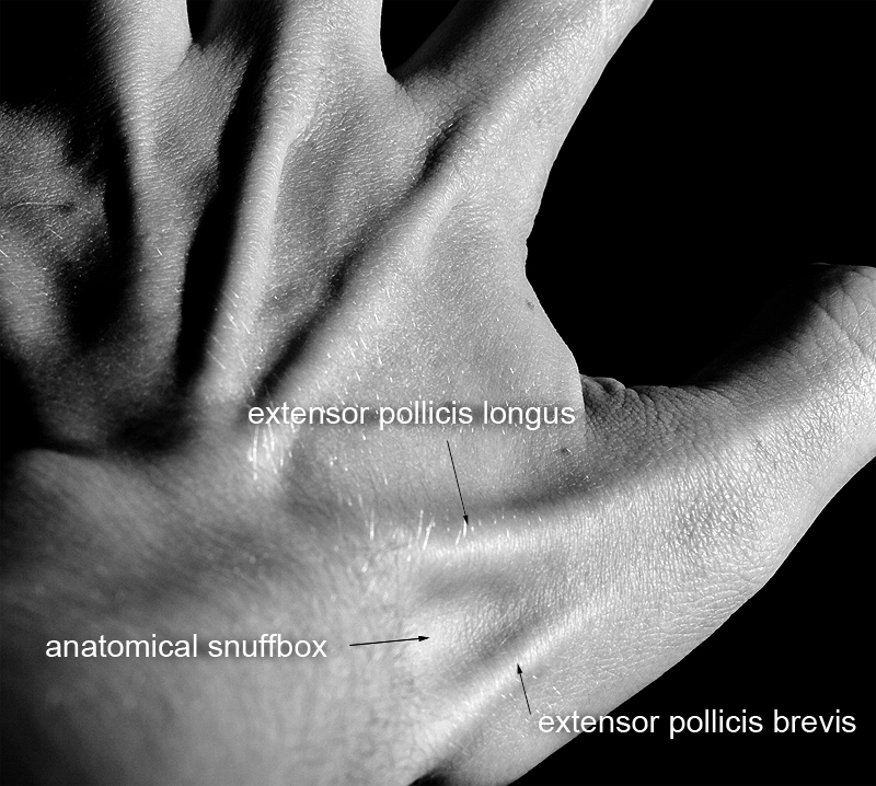 Surface Anatomy of Anatomical Snuff Box. From http://www.wikiradiography.net/page/Scaphoid+Radiography