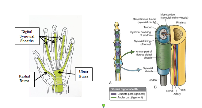 Left: Diagram of synovial sheaths and bursa in the palmar hand and wrist. From MacKinnon & Morris, Oxford Textbook of Functional Anatomy, Volume 1, Musculoskeletal System; 1986, Oxford University Press; 0-19-261517-3, Figure 6.12.4 Right:Diagram of fibrous digital sheath, illustrating the flexor tendon and its synovial sheath. From http://www.studyblue.com/notes/note/n/an-lec-08-wrist--hand/deck/3229011.