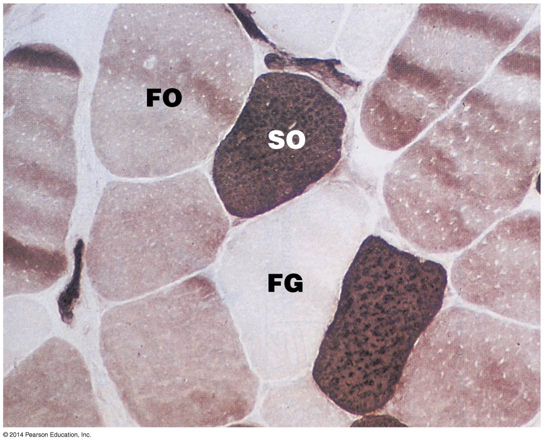 Histological image of the three types of skeletal muscle fibers.