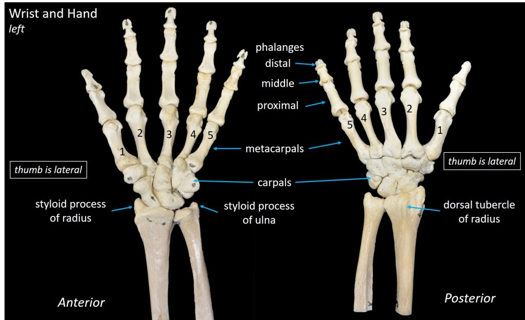Photograph of anterior and posterior views of the bones of the left wrist and hand with the bones labeled.
