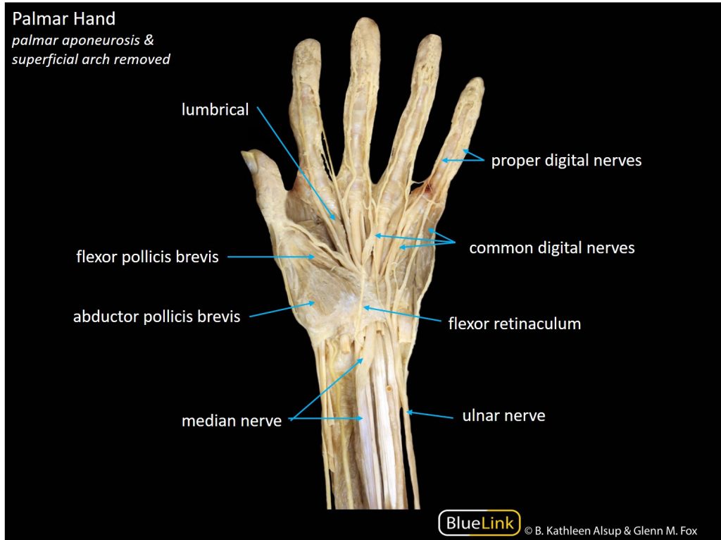 Photograph of a dissection of a palmar hand with the palmar aponeurosis removed.